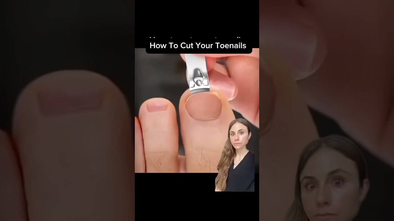 Never Get Another Ingrown Toenail With This Simple Fix 