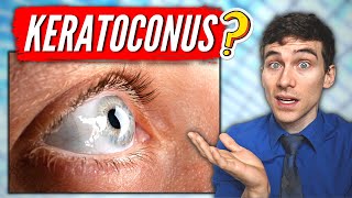 What is Keratoconus? (Keratoconus Eye Disease Explained) screenshot 2