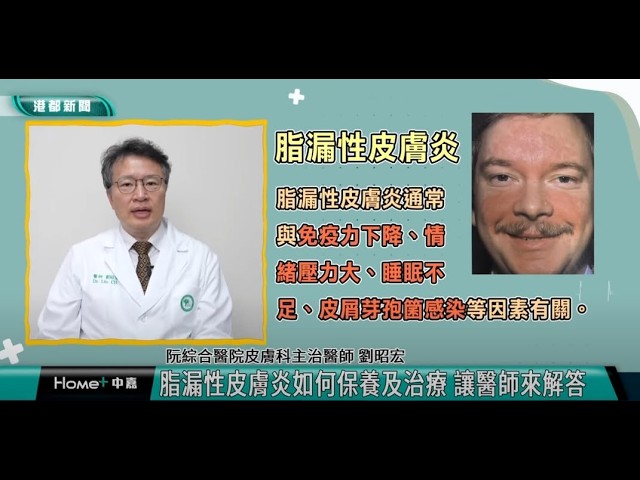 醫定要健康|脂漏性皮膚炎如何保養及治療 讓醫師來解答 feat.高雄都會台 - 中嘉寬頻 縮圖