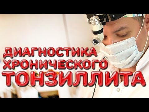 Видео: 7 способов измерить уровень инсулина в домашних условиях