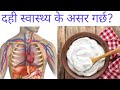 Curd health benefits in nepalidr bhupendra sha.octor sathi