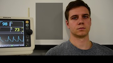 Eulerian Video Magnification