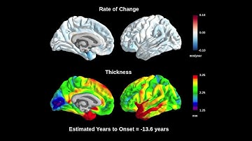 Voxel-wise change in cortical thickness by MRI in mutation carriers