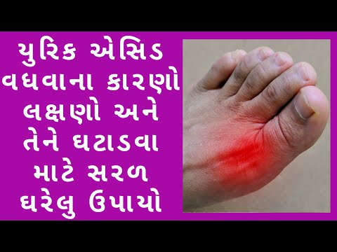 યુરિક એસિડ ના લક્ષણો | યુરિક એસિડ તાત્કાલિક ઘટાડો | How to control Uric acid naturally