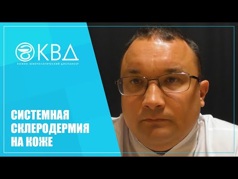 1424  Системная склеродермия на коже