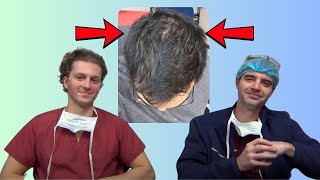 Can Diffuse Thinners Get a Hair Transplant?