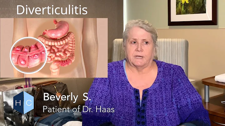 Diverticulitis Treatment by Dr. Eric Haas - Beverl...