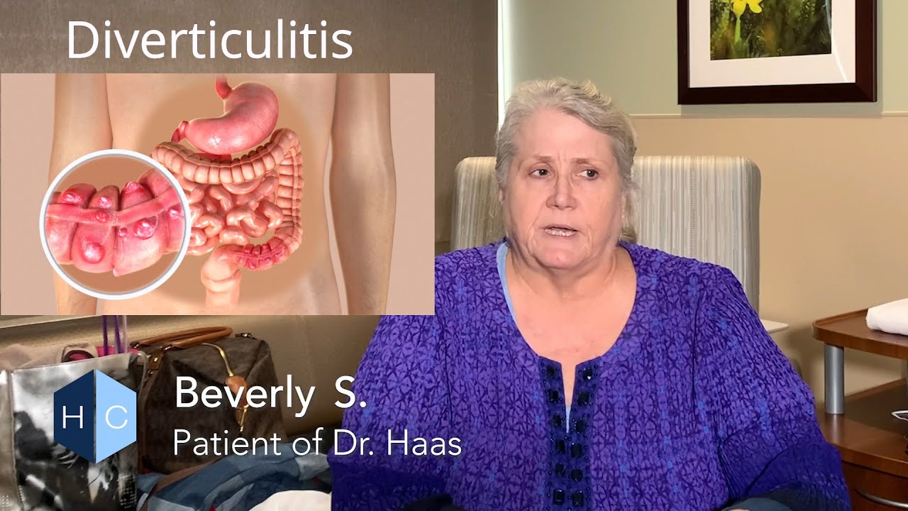 Diverticulitis Treatment by Dr. Eric Haas - Beverly's Story
