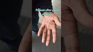 hand movement #physiotherapist #painrelief #neckpain #healthtips #shortsfeed