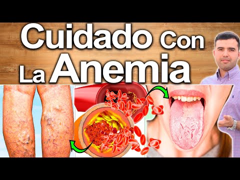 Video: Di No A La Anemia