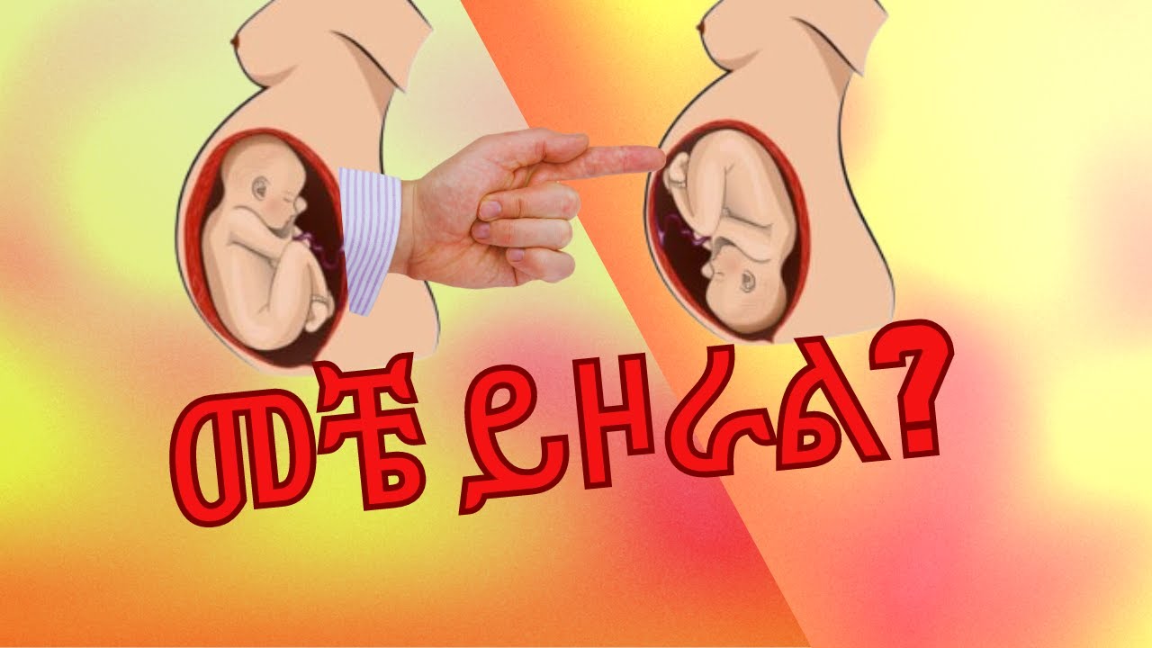 የፅንስ አቀማመጥ በስንተኛው ሳምንት በራሱ ሊስተካከል/ሊዞር ይችላል?/ What week does the baby turn from breech to cephalic?