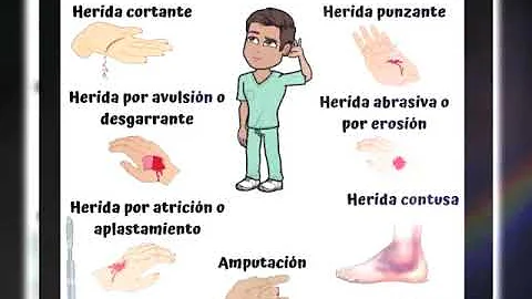 ¿Cuáles son los 4 tipos de heridas?