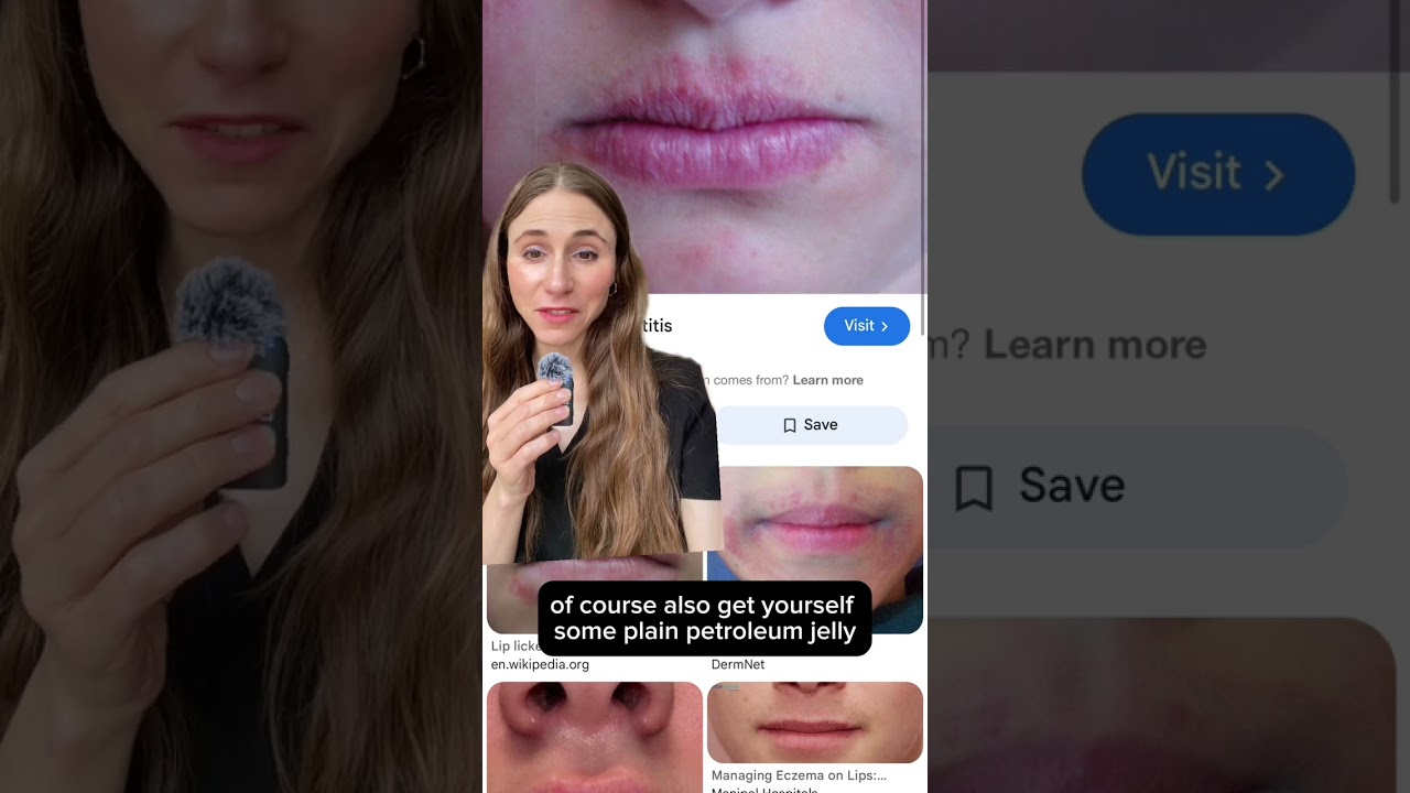 Советы дерматолога по заживлению потрескавшихся и обветренных губ 