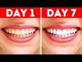 TEETH HACKS || BEFORE AND AFTER