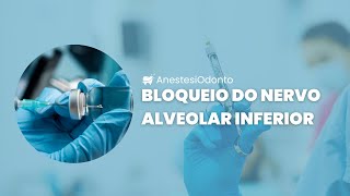 🦷✨ Bloqueio do Nervo Alveolar Inferior – Técnica Clínica Visual ✨🦷