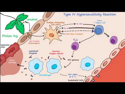 Type IV Hypersensitivity (Described Concisely)