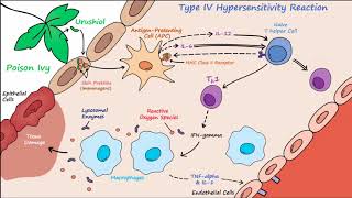 Type IV Hypersensitivity (Described Concisely)