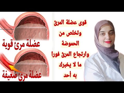 فيديو: هل يمكن للعضلة العاصرة السفلية للمريء إصلاح نفسها؟