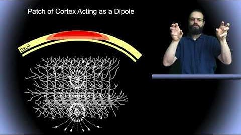 ICA applied to EEG part 5: Source localization of ICA components