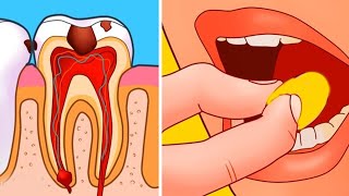 How To Stop A Toothache And Get Out Of Pain Fast In a Minute