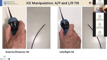 6 5 20 Zei Basic ICE in EP