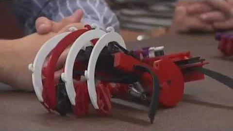 University students design 3D printed hand exoskeleton