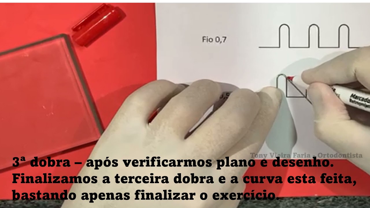 Conceitos básicos de dobras de fio ortodôntico 2 parte
