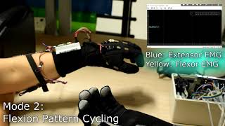 A Soft Robotic Glove Utilising Wireless sEMG and Flex Sensors for Intent-driven Hand Rehabilitation screenshot 5