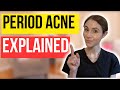 Why you get period acne and hormonal breakouts