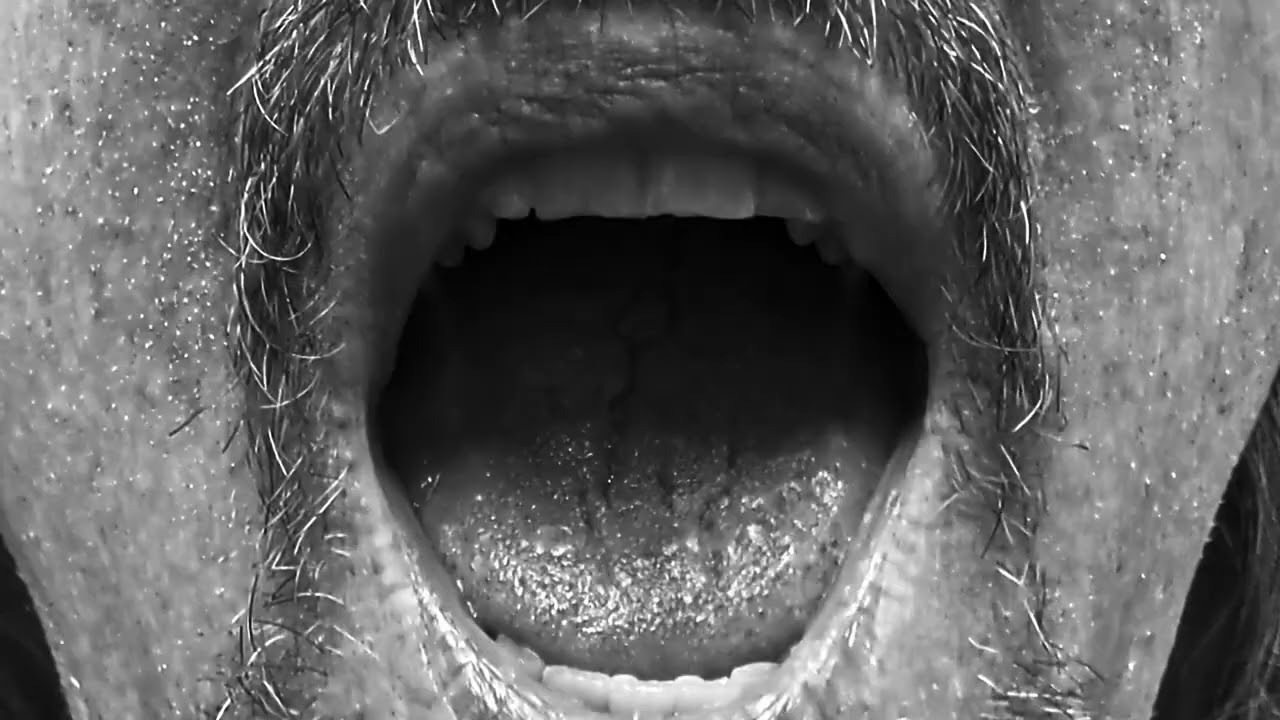 Watch The Reed Effect - Mad Dog (Official) on YouTube Watch The Reed Effect - Mad Dog (Official) on YouTube