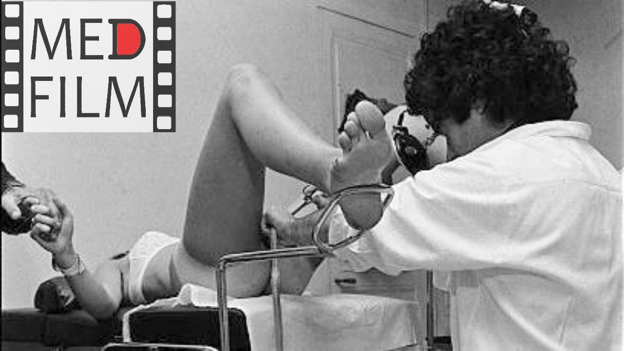 Аборт методом вакуум-экскохлеации © Abortion by vacuum excretion