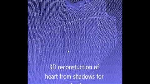 3D reconstruction of real heart using tool shadows for minimally invasive surgery