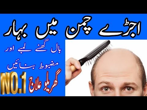 گنجے پن کا علاج|بال گرنے کیسے بند ہونگے| hair care tips|farooqi dawakhana|
