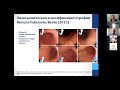 3. Ткаченко М.А Своевременное выявление предраковых изменений и заболеваний желудка в клин практике