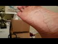 HOME SPA FOOT PEEL...SHOCKING results. DRY HEEL BE GONE!! How to get baby skin feet.