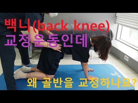 (Eng)백니[back knee] 교정인데 골반교정을 먼저하는 이유? 휜다리, 반장슬 교정운동 Genu recurvatum, valgus, varus, knock knees