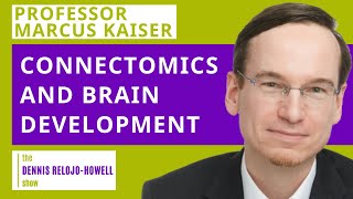 Professor Marcus Kaiser Connectomics And Brain Development