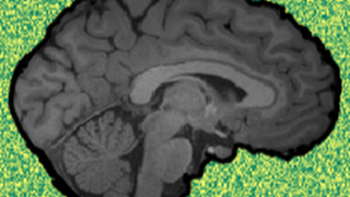 OHBM Brainhack 2020