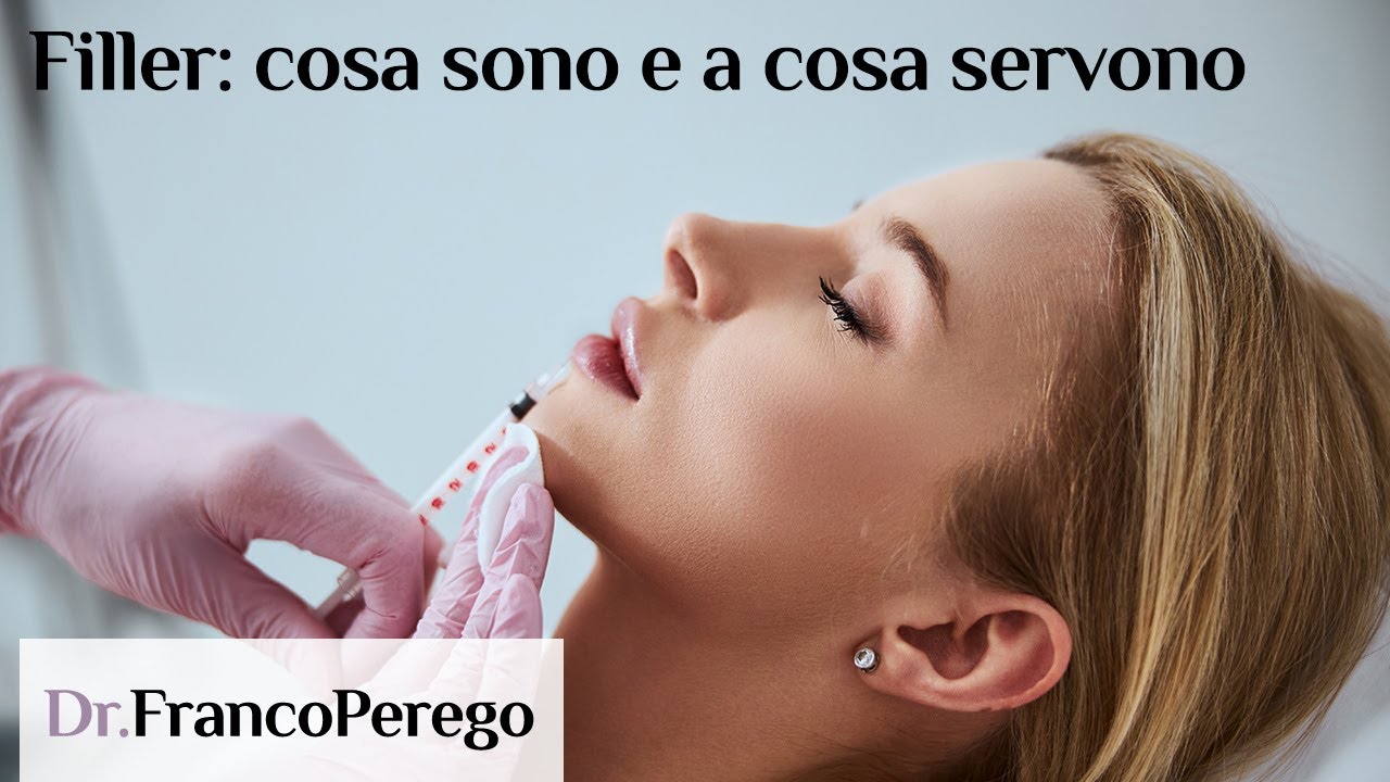 Filler a base di acido ialuronico - cosa sono e a cosa servono