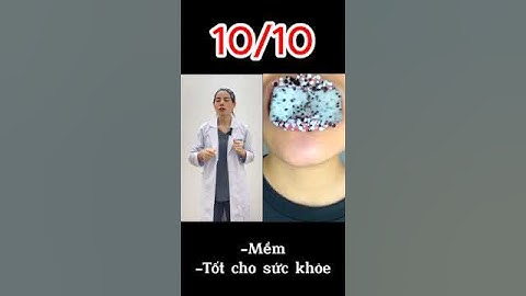 Niềng Răng Ăn Gì? | Đồ Ăn Nào Tốt Cho Răng Niềng #1