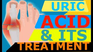 बढे हुए URIC ACID को जल्दी कम करने के लिए क्या ना खाये और क्या खाये | URIC ACID FOODS TO AVOID