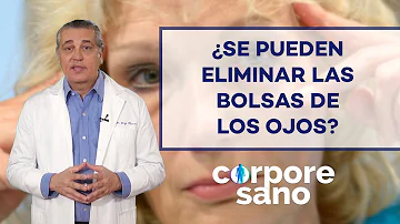 ¿Cómo se eliminan las bolsas de los ojos debidas al envejecimiento?