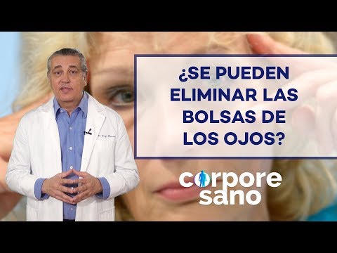 Video: Cómo eliminar los puntos negros de forma natural (método de vapor y toalla)