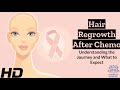 Hair Rebirth: The Remarkable Journey After Chemo