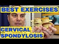 4 Best Exercises for Cervical Spondylosis | Dr. Walter Salubro Chiropractor in Vaughan ON