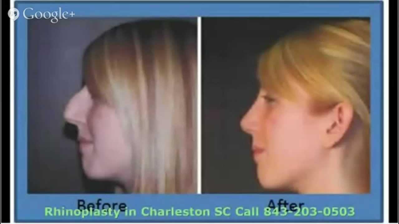 может ли нос измениться