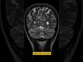 Don_t miss the last trick __🧠 Your brain doesn_._Here are 6 powerful hacks to study smarter#shorts