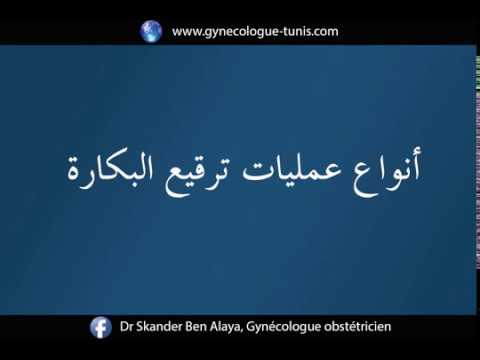 حقائق و نصائح حول ترقيع البكارة