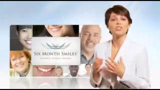 Six Month Smiles Dentist at Grove City Dental