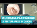  cancer du rectum  tout savoir sur la chirurgie de prservation 